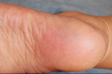 After Swiss Pedicare foot care treatment
