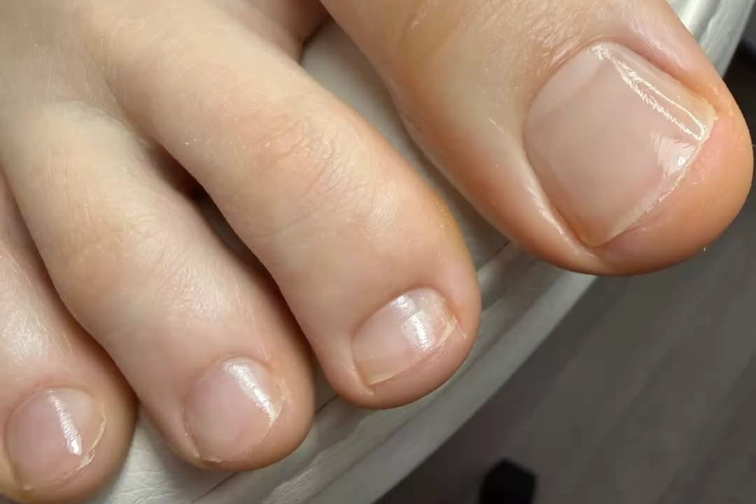 After Swiss Pedicare foot care treatment